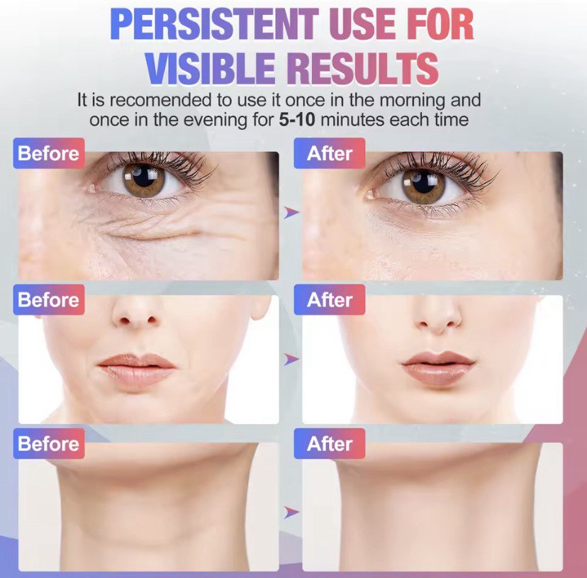 Ultra LED – EMS  Face & Neck Lifting Device.